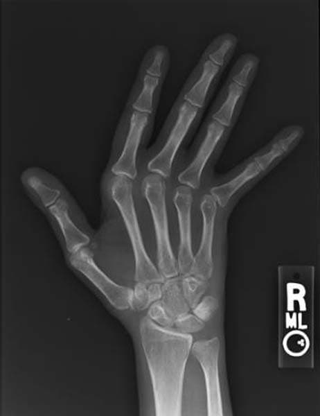Limb & Joint X-rays